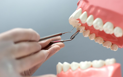 Çorlu Periodontoloji Tedavisi - Akçadent Ağız ve Diş Sağlığı Polikliniği